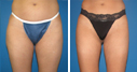 Before & After Photos